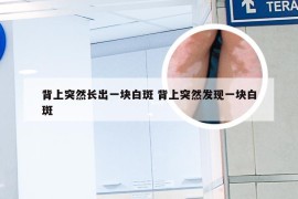 背上突然长出一块白斑 背上突然发现一块白斑