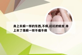 身上长癣一样的东西,不痒,红红的蜕皮 身上长了像癣一样不痛不痒