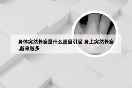 身体突然长癣是什么原因引起 身上突然长癣,越来越多