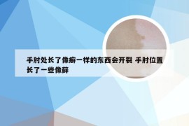 手肘处长了像癣一样的东西会开裂 手肘位置长了一些像藓