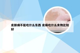 皮肤病不能吃什么东西 皮癣吃什么食物比较好