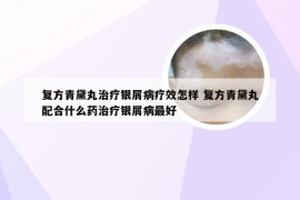 复方青黛丸治疗银屑病疗效怎样 复方青黛丸配合什么药治疗银屑病最好