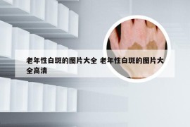 老年性白斑的图片大全 老年性白斑的图片大全高清