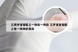 三周半宝宝脸上一块白一块白 三岁宝宝宝脸上有一块块的发白