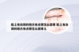 脸上有白斑的地方有点硬怎么回事 脸上有白斑的地方有点硬怎么回事儿