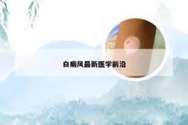 白癜风最新医学前沿