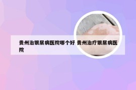 贵州治银屑病医院哪个好 贵州治疗银屑病医院