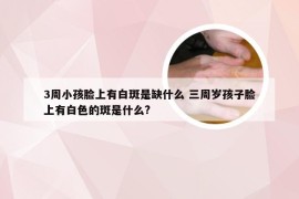 3周小孩脸上有白斑是缺什么 三周岁孩子脸上有白色的斑是什么?