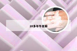 20多年牛皮癣