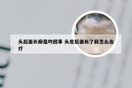 头后面长癣是咋回事 头皮后面长了藓怎么治疗