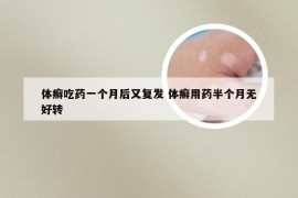 体癣吃药一个月后又复发 体癣用药半个月无好转