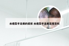 水疱型手足癣的症状 水疱型手足癣百度百科