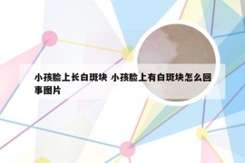 小孩脸上长白斑块 小孩脸上有白斑块怎么回事图片