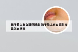 孩子脸上有白斑还脱皮 孩子脸上有白斑脱皮是怎么回事