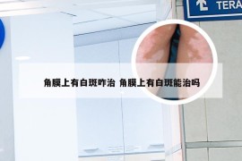 角膜上有白斑咋治 角膜上有白斑能治吗