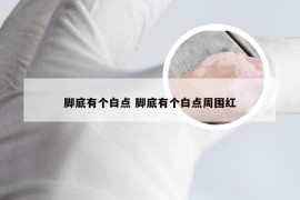 脚底有个白点 脚底有个白点周围红