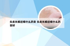 头皮长癣还痒什么药膏 头皮长癣还痒什么药膏好