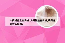 大拇指盖上有白点 大拇指盖有白点,请问这是什么原因?