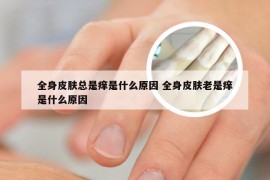 全身皮肤总是痒是什么原因 全身皮肤老是痒是什么原因