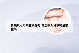 白癜风可以喝金银花吗 白斑病人可以喝金银花吗