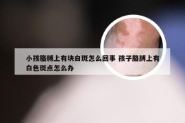 小孩胳膊上有块白斑怎么回事 孩子胳膊上有白色斑点怎么办