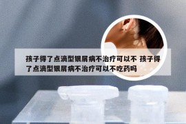 孩子得了点滴型银屑病不治疗可以不 孩子得了点滴型银屑病不治疗可以不吃药吗