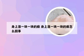 身上涨一块一块的癣 身上涨一块一块的癣怎么回事