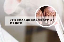 6岁孩子脸上长白斑是怎么回事 6岁的孩子脸上有白斑