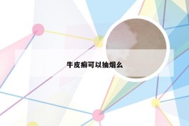 牛皮癣可以抽烟么