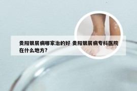 贵阳银屑病哪家治的好 贵阳银屑病专科医院在什么地方?