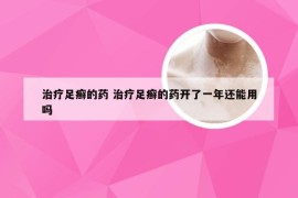 治疗足癣的药 治疗足癣的药开了一年还能用吗