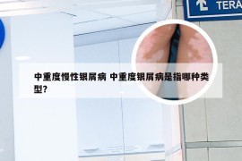 中重度慢性银屑病 中重度银屑病是指哪种类型?