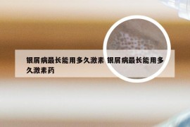 银屑病最长能用多久激素 银屑病最长能用多久激素药