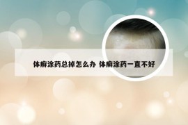 体癣涂药总掉怎么办 体癣涂药一直不好