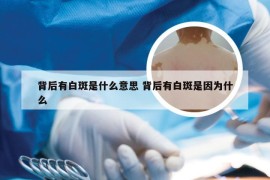 背后有白斑是什么意思 背后有白斑是因为什么