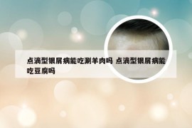 点滴型银屑病能吃涮羊肉吗 点滴型银屑病能吃豆腐吗