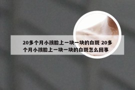 20多个月小孩脸上一块一块的白斑 20多个月小孩脸上一块一块的白斑怎么回事