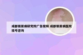 成都银屑病研究院广告视频 成都银屑病医院挂号咨询