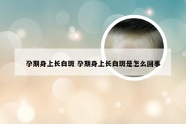 孕期身上长白斑 孕期身上长白斑是怎么回事