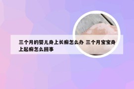 三个月的婴儿身上长癣怎么办 三个月宝宝身上起癣怎么回事