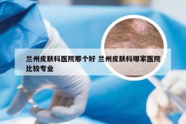 兰州皮肤科医院那个好 兰州皮肤科哪家医院比较专业