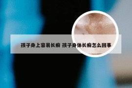 孩子身上容易长癣 孩子身体长癣怎么回事