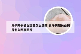 鼻子两侧长白斑是怎么回事 鼻子两侧长白斑是怎么回事图片