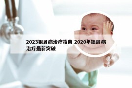 2023银屑病治疗指南 2020年银屑病治疗最新突破