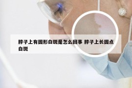 脖子上有圆形白斑是怎么回事 脖子上长圆点白斑