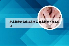 身上长癣饮食应注意什么 身上长癣有什么忌口