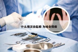 什么情况会起癣 为啥会得癣