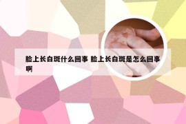 脸上长白斑什么回事 脸上长白斑是怎么回事啊