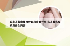 头皮上长癣要用什么药膏好一点 头上有头皮癣用什么药膏