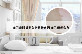 毛孔皮肤病怎么治用什么药 毛孔痒怎么办